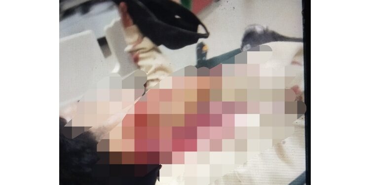 FOTO: AGUS/MATA KALTENG - Korban penusukan di salah satu warung Jalan Suprapto, Kecamatan MB Ketapang, Kotim, saat dirawat dirumah sakit RSUD dr Murjani Sampit, Minggu 20 Agustus 2023 lalu.