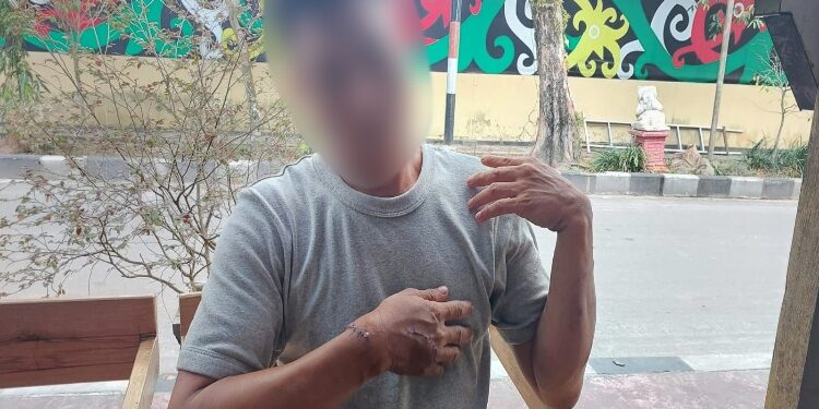 FOTO: RZL/MATAKALTENG - Korban Pani ketika menunjukkan bekas luka bacokan parang saat kejadian.