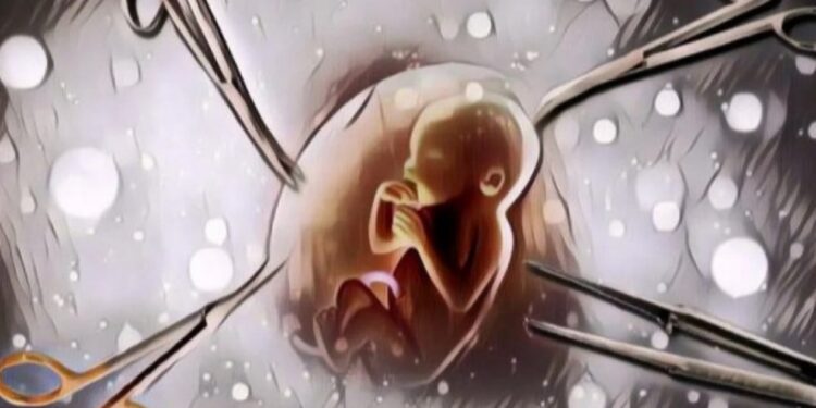 FOTO: MATAKALTENG - Ilustrasi aborsi.