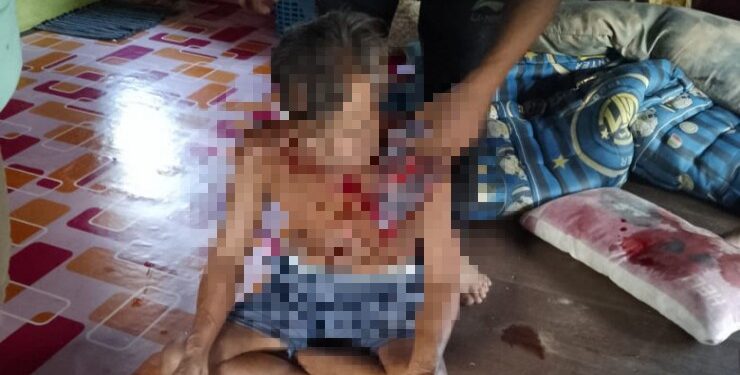 FOTO : POLSEK MANUHING/MATA KALTENG - Korban penganiayaan Dawon Jidan (65) mengalami sejumlah luka usai dianiaya, belum lama ini.