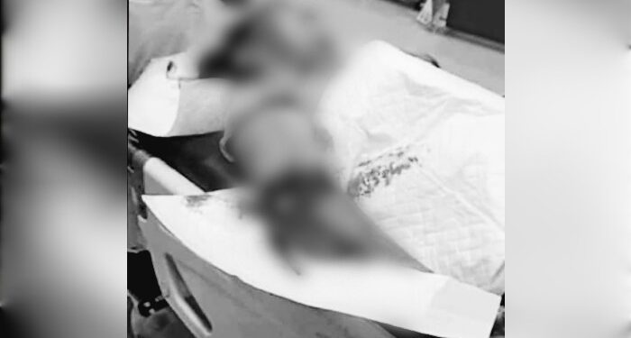 FOTO: IST/MATAKALTENG - Nenek Lawiyah saat di RSUD dr Murjani Sampit, Kamis 23 Mei 2024.