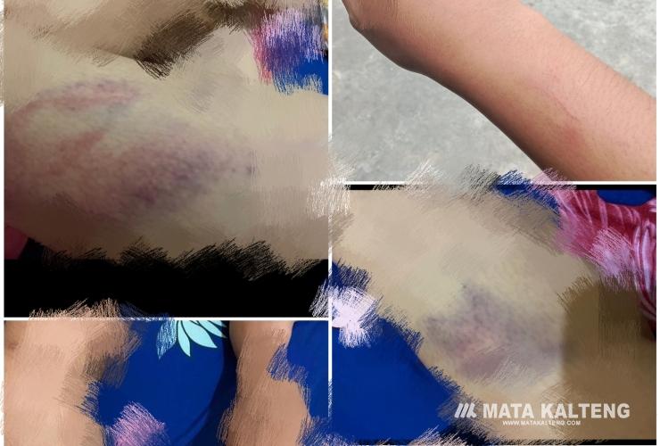 Korban KDRT di Sampit Lapor ke Polisi, Pelaku Belum Ditindaklanjuti